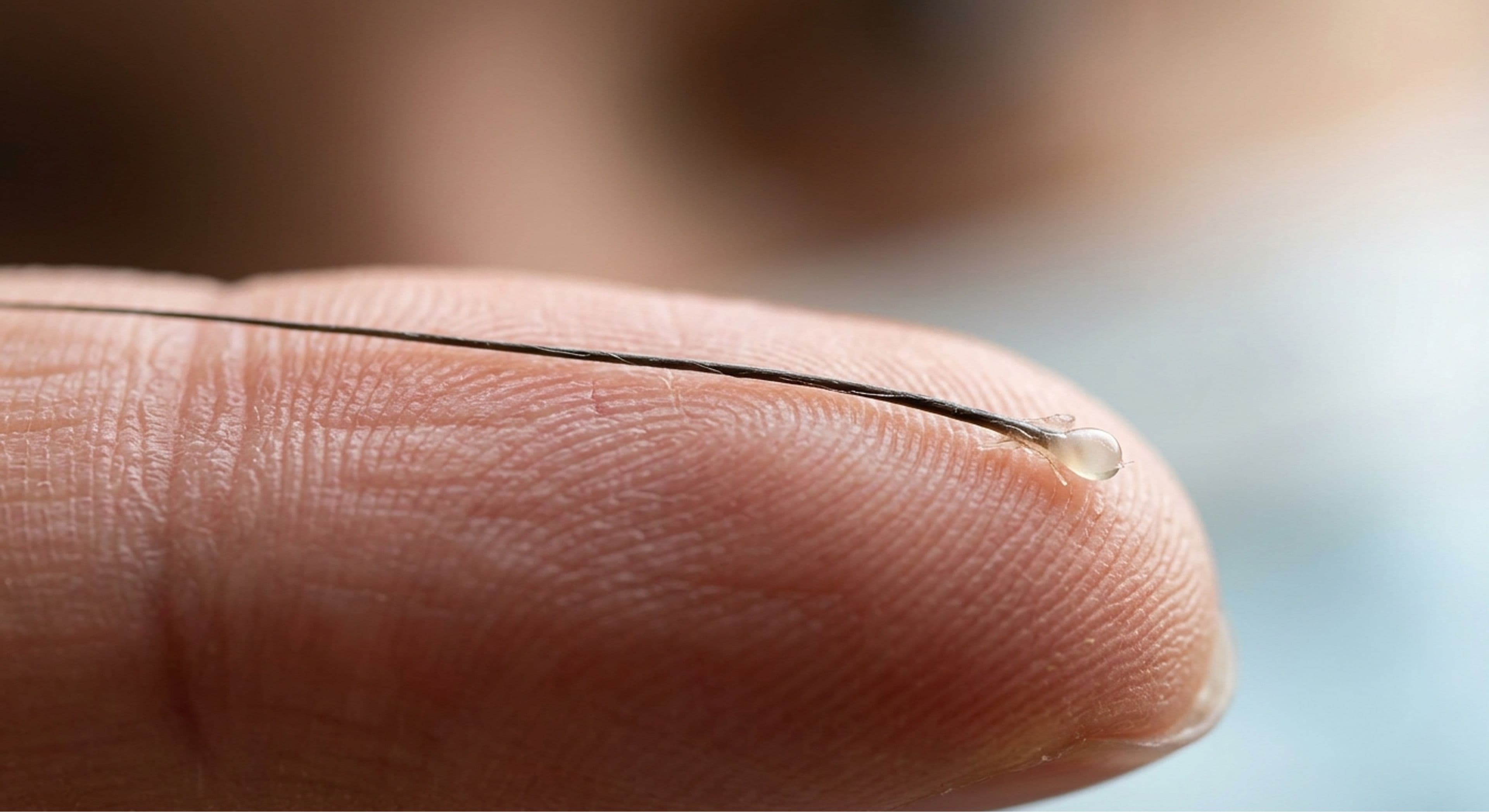 Close-up of a single human hair with a white bulb on the root, showing natural hair shedding and hair loss.